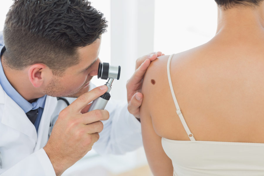 Skin Cancer Management